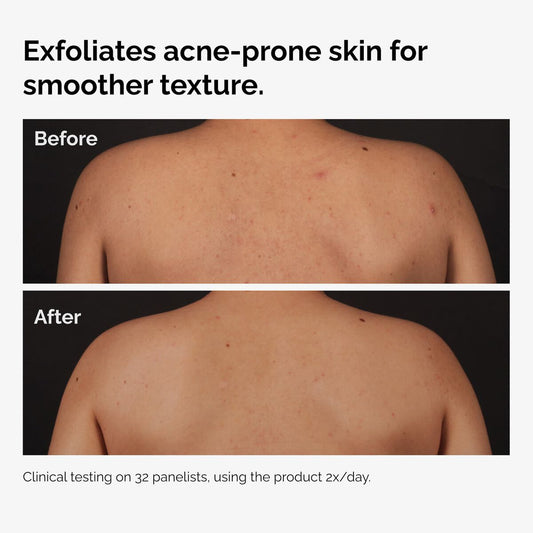 SerumSalicylic Acid 0.5% Body Serum