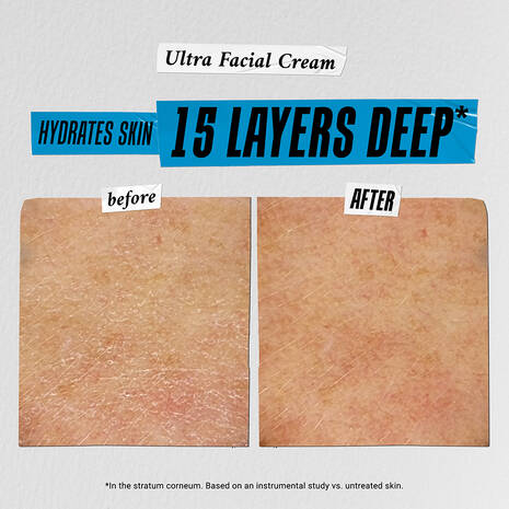 Hydrate, Treat & Repeat Trial Set