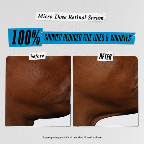 Hydrate, Treat & Repeat Trial Set