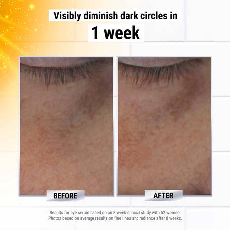 powerful strength line reducing & dark circle diminishing vit c eye serum