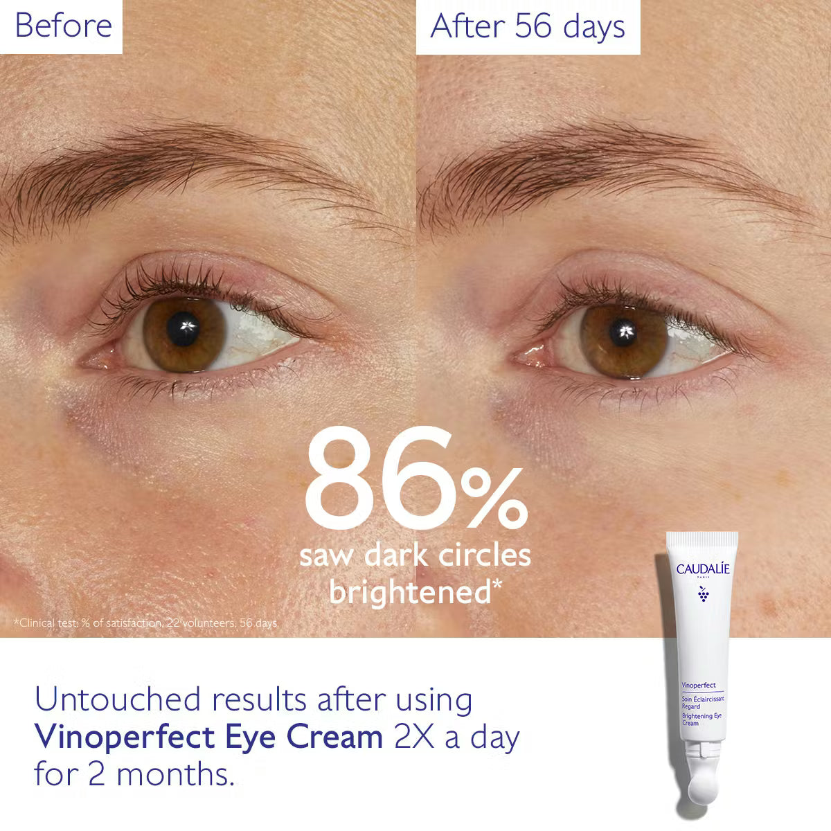 Dark Circle Brightening Eye Cream with Niacinamide