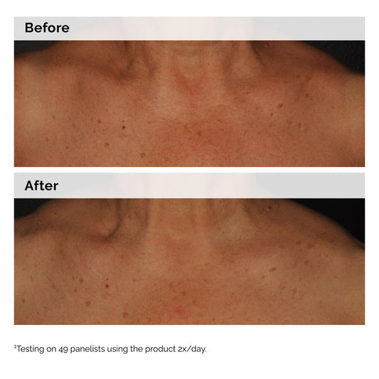 EmulsionNiacinamide 5% Face and Body Emulsion