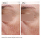 EmulsionNiacinamide 5% Face and Body Emulsion