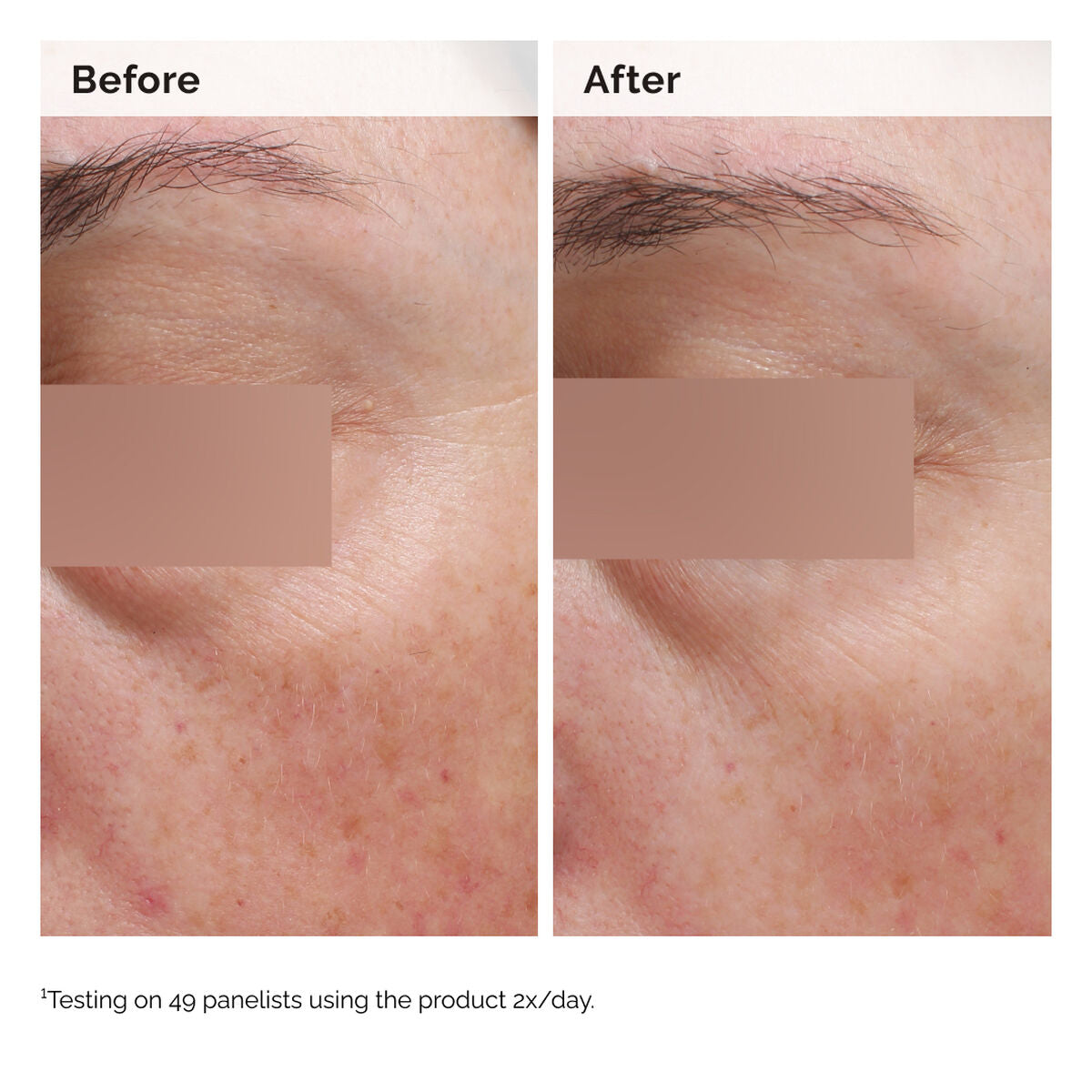 EmulsionNiacinamide 5% Face and Body Emulsion