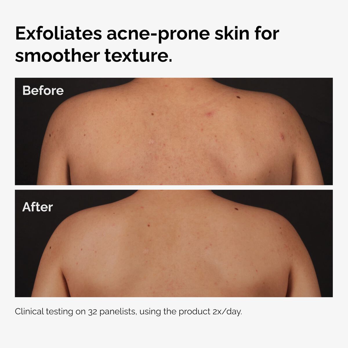 SerumSalicylic Acid 0.5% Body Serum