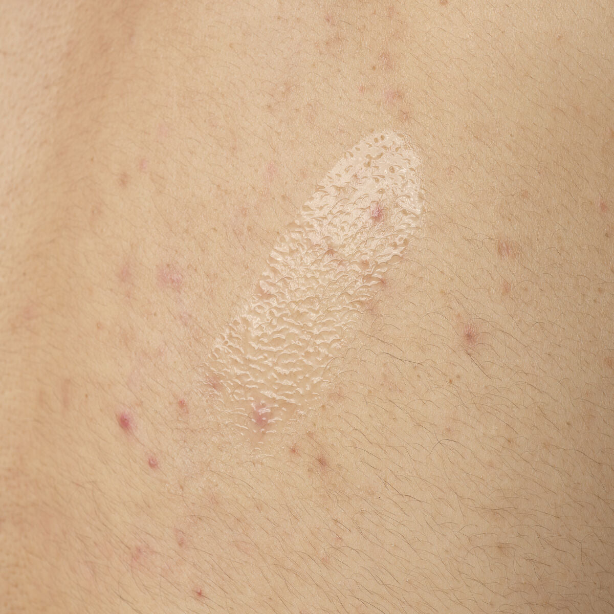 SerumSalicylic Acid 0.5% Body Serum
