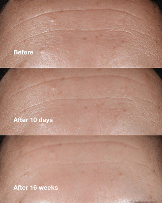 Clinique Smart Clinical Repair™ Wrinkle Correcting Serum