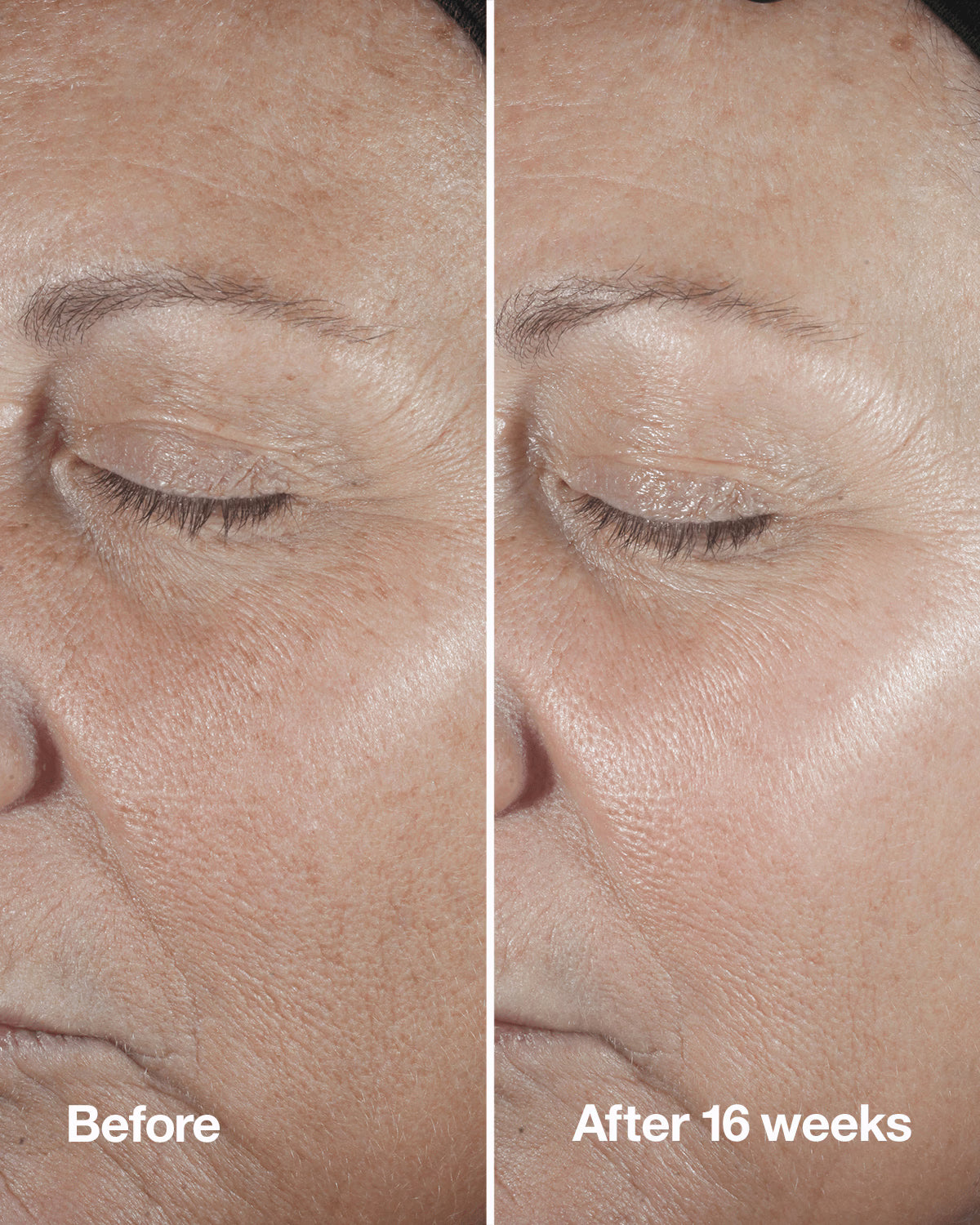 Clinique Smart Clinical Repair™ Wrinkle Correcting Serum