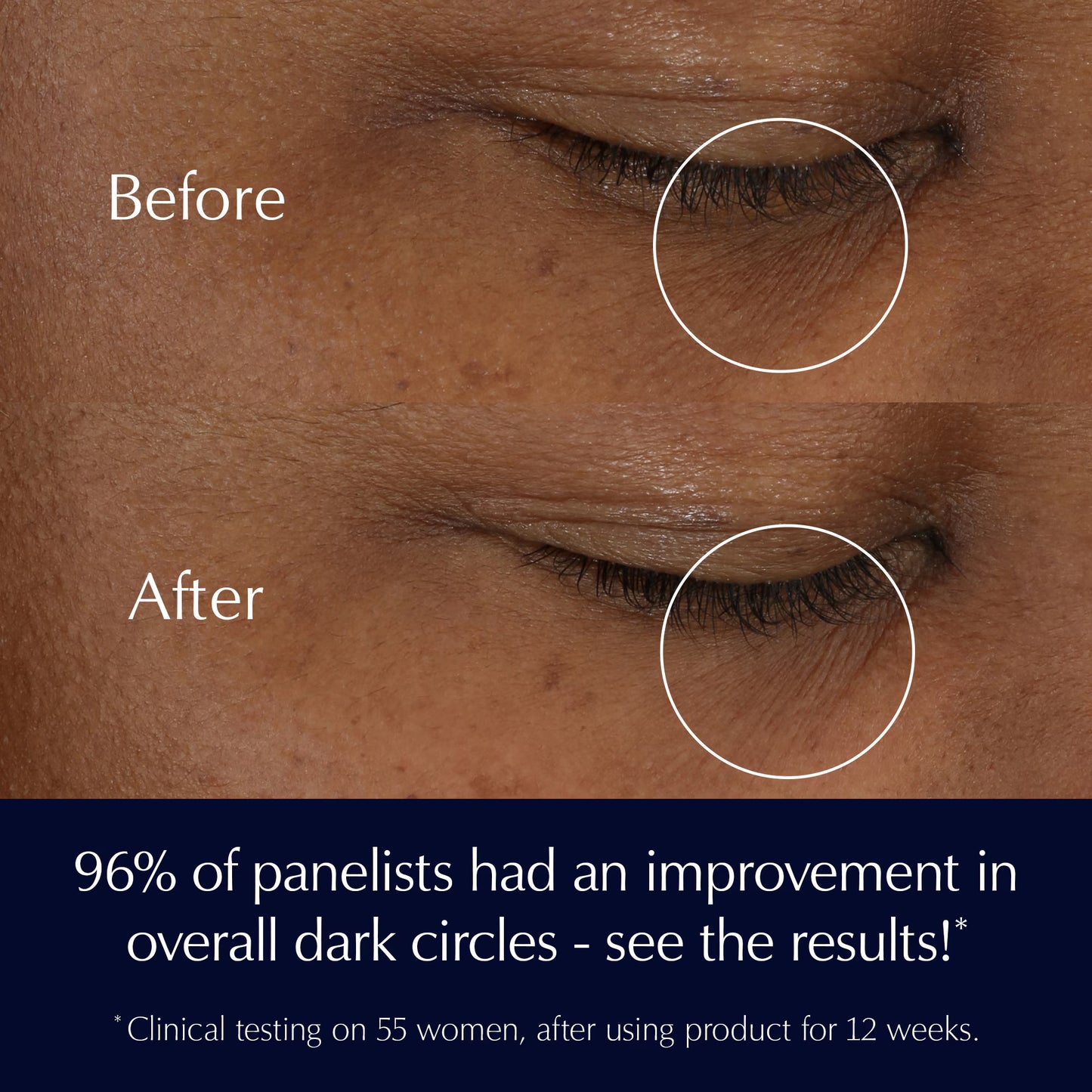 Advanced Night Repair Eye Cream