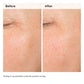 Alpha Arbutin 2% + Hyaluronic Acid for Hyperpigmentation